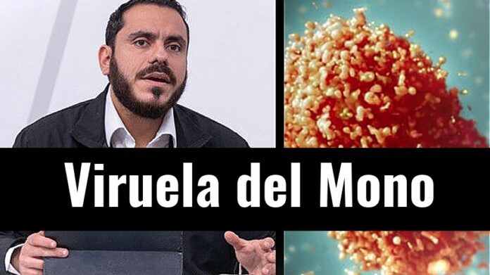 ContraPunto El Salvador - Viruela del Mono es confirmado por Francisco Alabí. Hay vacuna