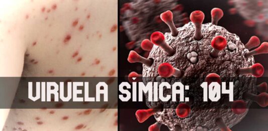ContraPunto El Salvador - 104 casos Viruela Símica, 0 de Gripe Aviar