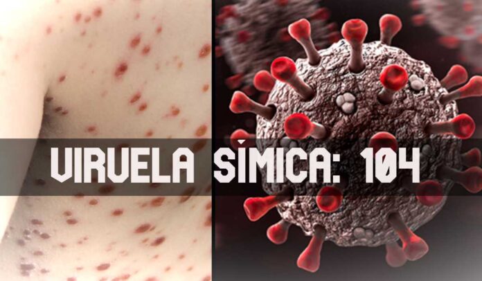 ContraPunto El Salvador - 104 casos Viruela Símica, 0 de Gripe Aviar